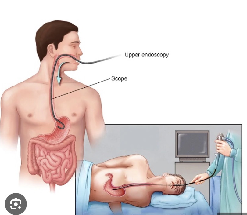 Gastroscopy